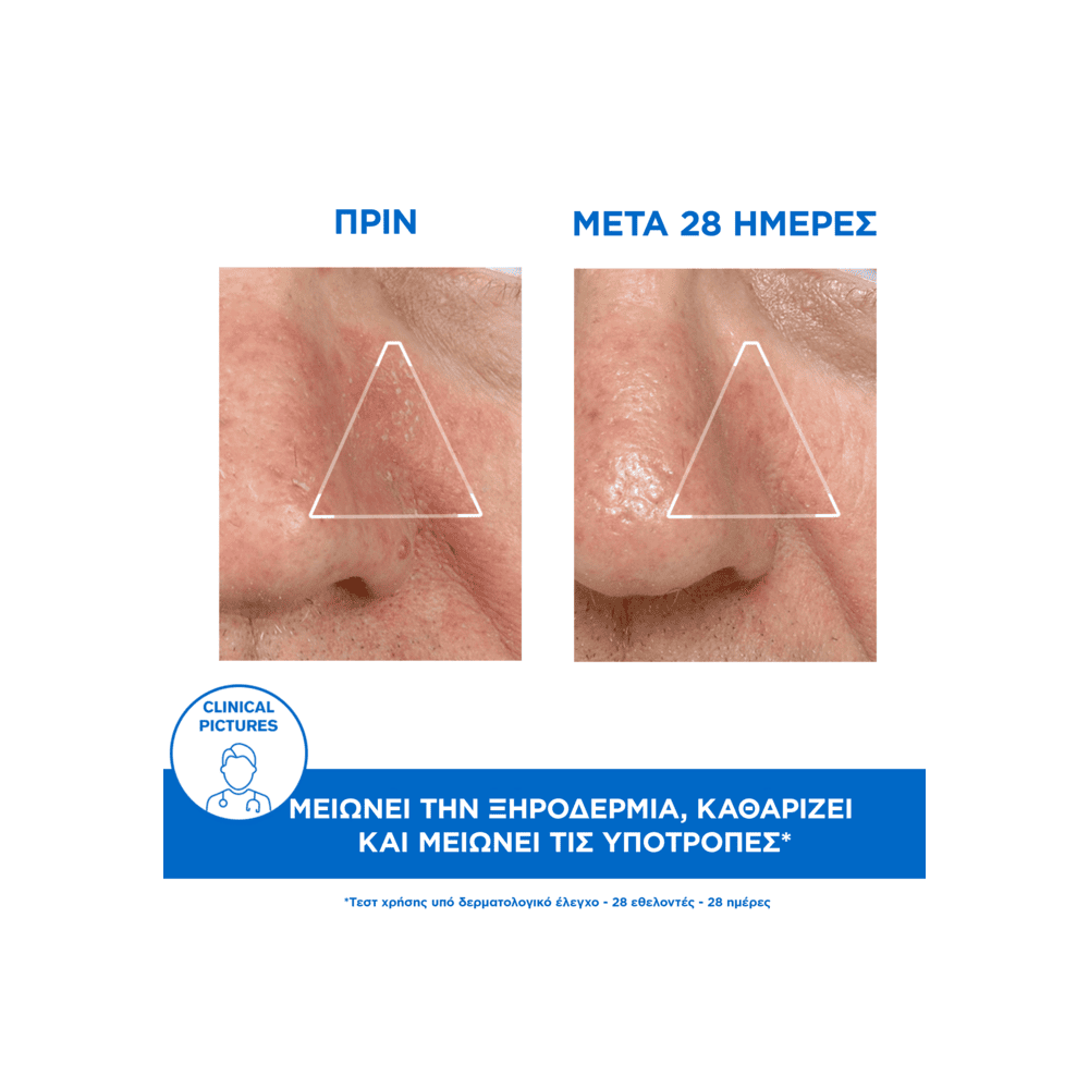 Preview 2 of Uriage D.S. Emulsion Σμηγματορυθμιστική Κρέμα 40ml